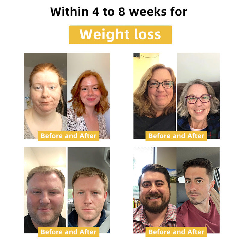 🐝Bee Venom Lymphatic Drainage & Slimming Nose Ring⭐(for all lymphatic problems and obesity)