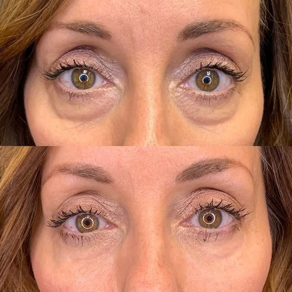 Anti-wrinkle Magic Eye Creamš„BUY 2 GET 1 FREEš„