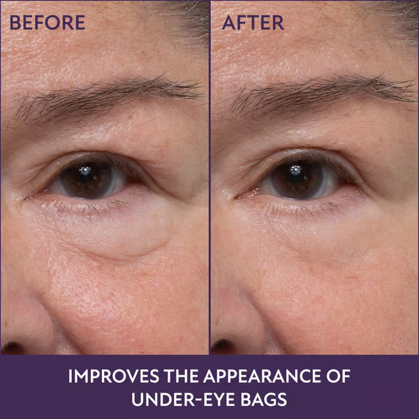 Anti-wrinkle Magic Eye Creamš„BUY 2 GET 1 FREEš„