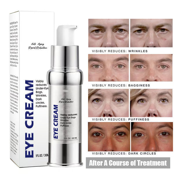 Anti-wrinkle Magic Eye Creamš„BUY 2 GET 1 FREEš„