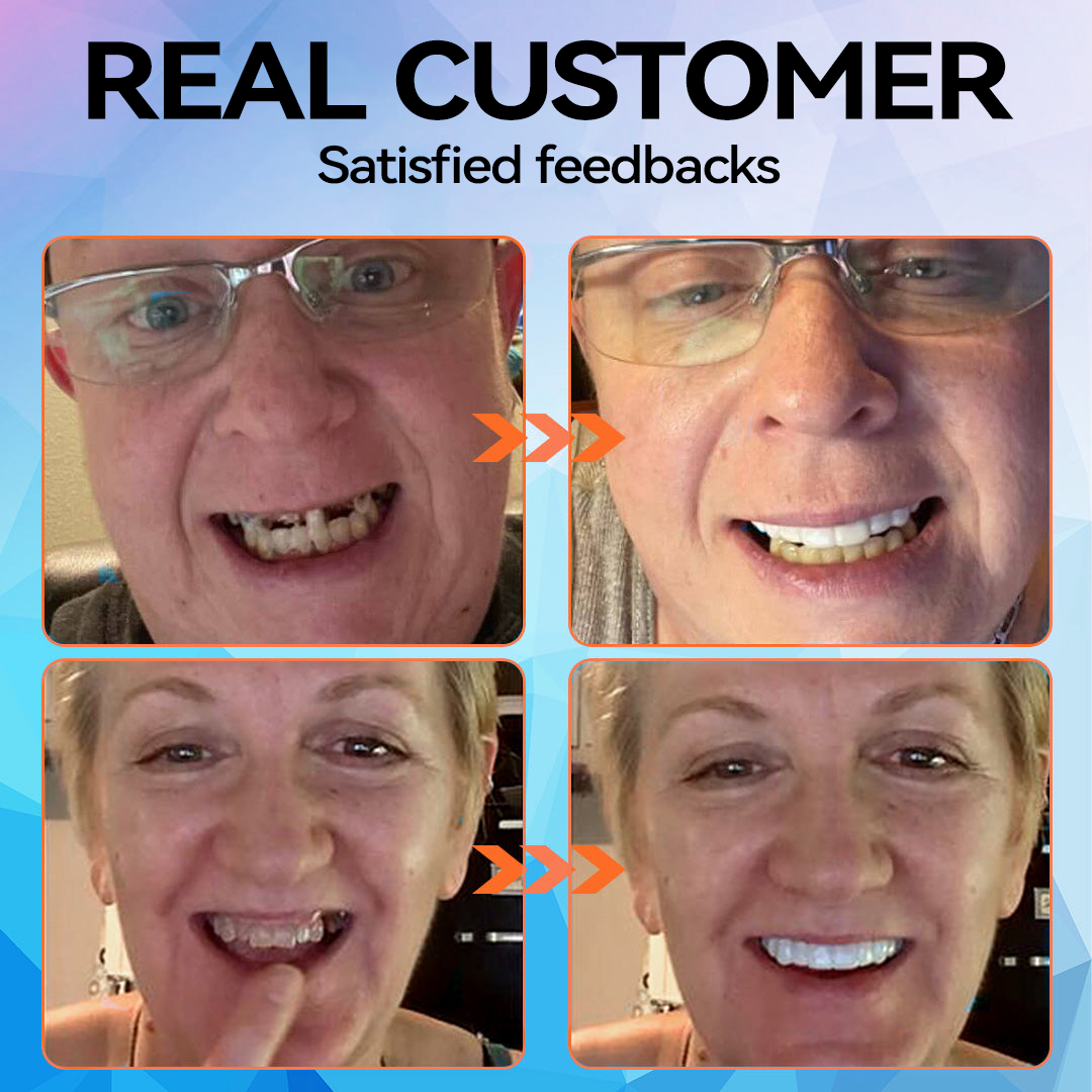 Official Store |Minceetbien™🗽 Moldable Dentures(⏰Limited Time 80% Off - Last 30 Minutes ⏰)