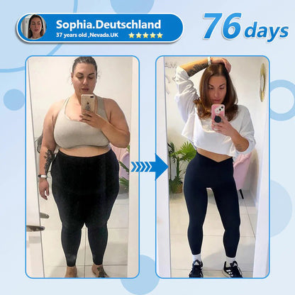 Yestree®👨‍⚕️ Nano Microneedle Patch with SMGT-GLP-1 & Matrixyl 3000 – Slimming, Skin Tightening, Blood Sugar Support, No Injection, 7-Day Result