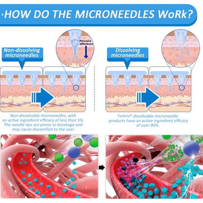 Yestree®👨‍⚕️ Nano Microneedle Patch with SMGT-GLP-1 & Matrixyl 3000 – Slimming, Skin Tightening, Blood Sugar Support, No Injection, 7-Day Result