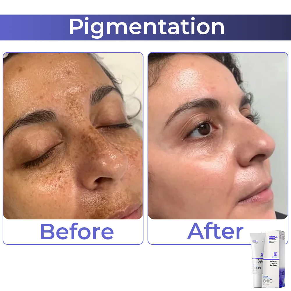 🧡 flysmus™ Collagen+ Wake Up Eye Cream 🇺🇸 Dermatologist Recommended