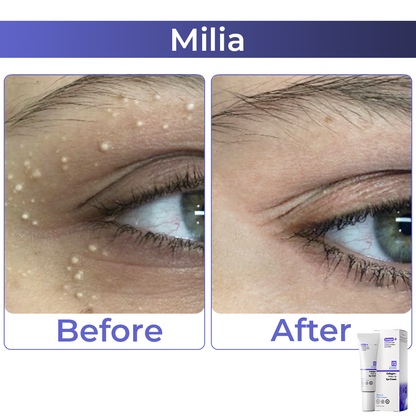 🧡 flysmus™ Collagen+ Wake Up Eye Cream 🇺🇸 Dermatologist Recommended