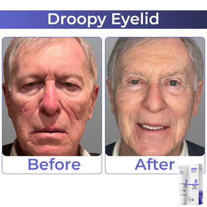 🧡 flysmus™ Collagen+ Wake Up Eye Cream 🇺🇸 Dermatologist Recommended